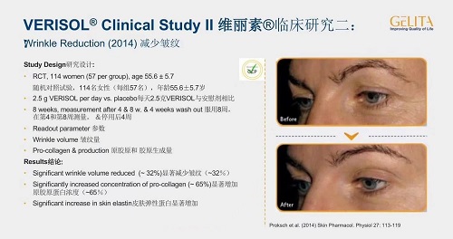 膠原蛋白好壞差在哪？怎樣選擇膠原蛋白？一次全解析