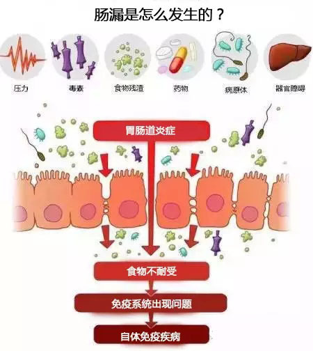 腸漏是什么原因造成的 吃什么有助于修復