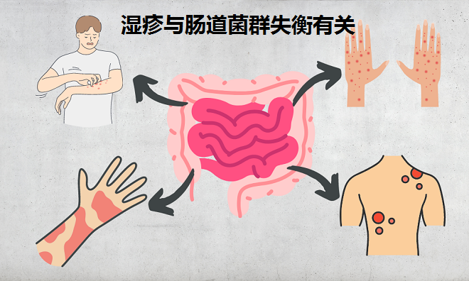 濕疹來(lái)報(bào)到 問(wèn)題在腸道 擺脫濕疹試試這招